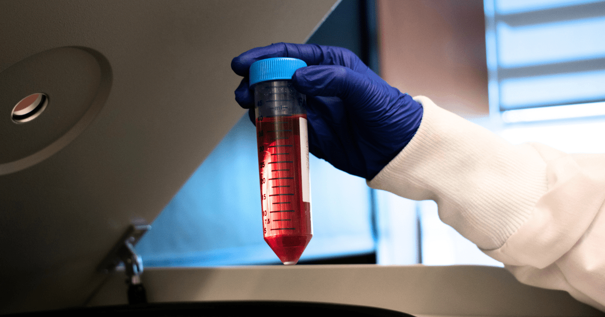 holding red fluid